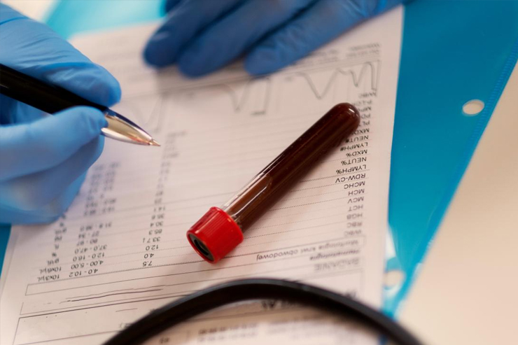 Getting Your Test Results